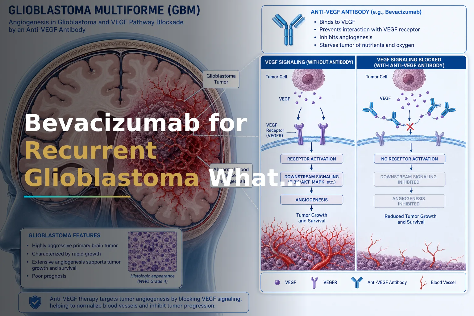 Bevacizumab for Recurrent Glioblastoma: What It Actually Does, Who It Helps, and What to Expect