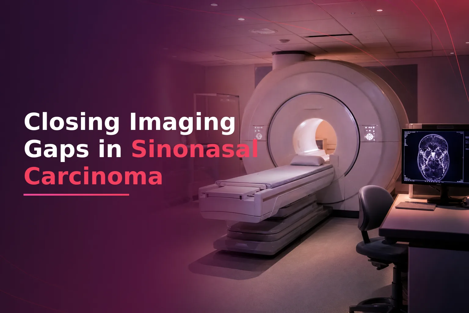 Imaging Coordination Gaps in Sinonasal Carcinoma Post-Resection