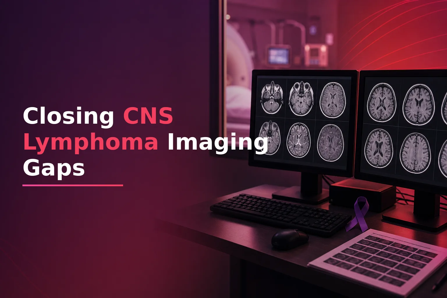 Imaging Surveillance Gaps in Primary CNS Lymphoma