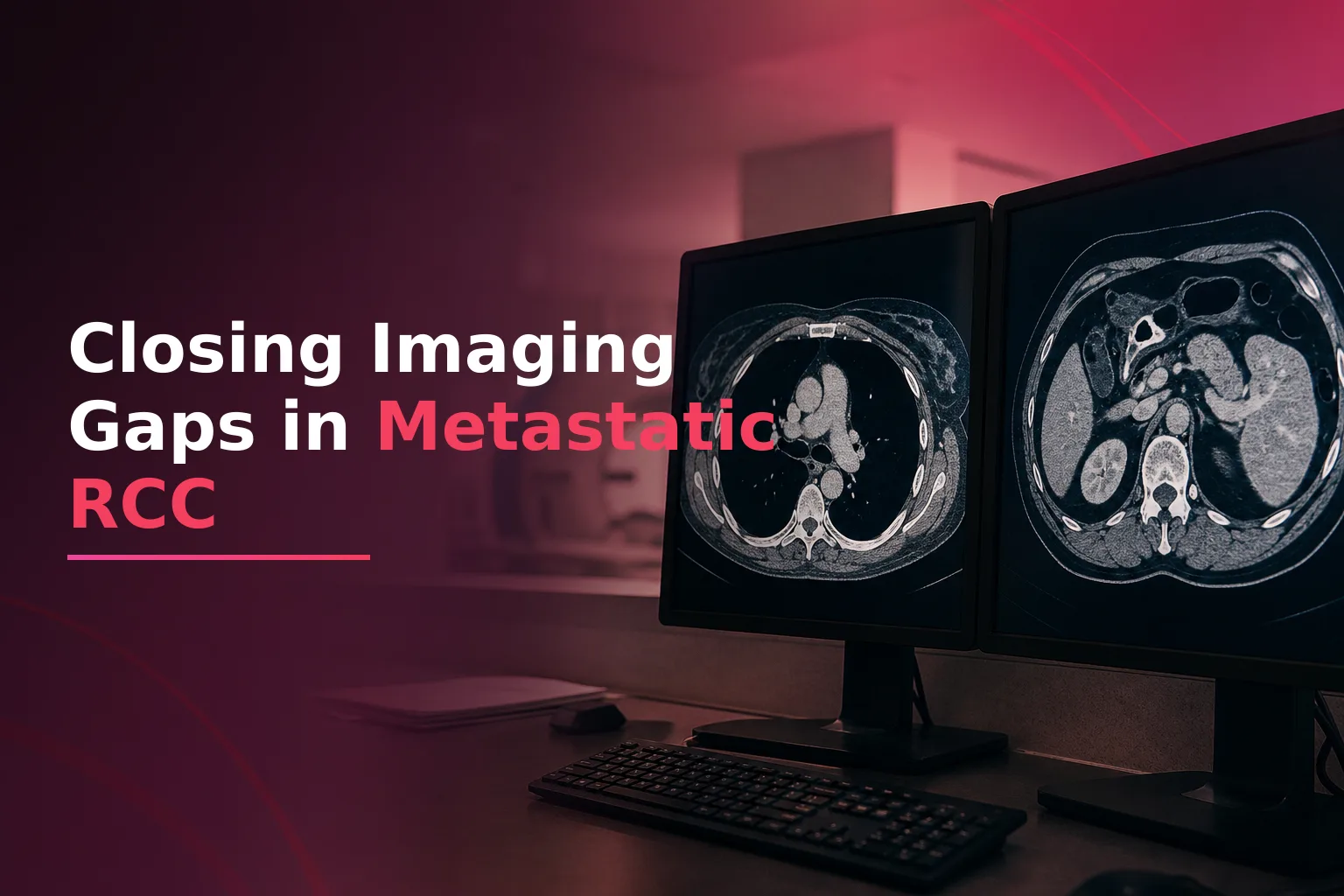 Imaging Gaps at TKI-to-Immunotherapy Switch in Metastatic RCC